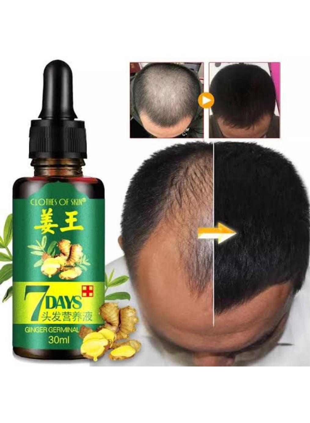 Nourishing Hair Growth Serum - 30ml for All Hair Types, 1 Pcs