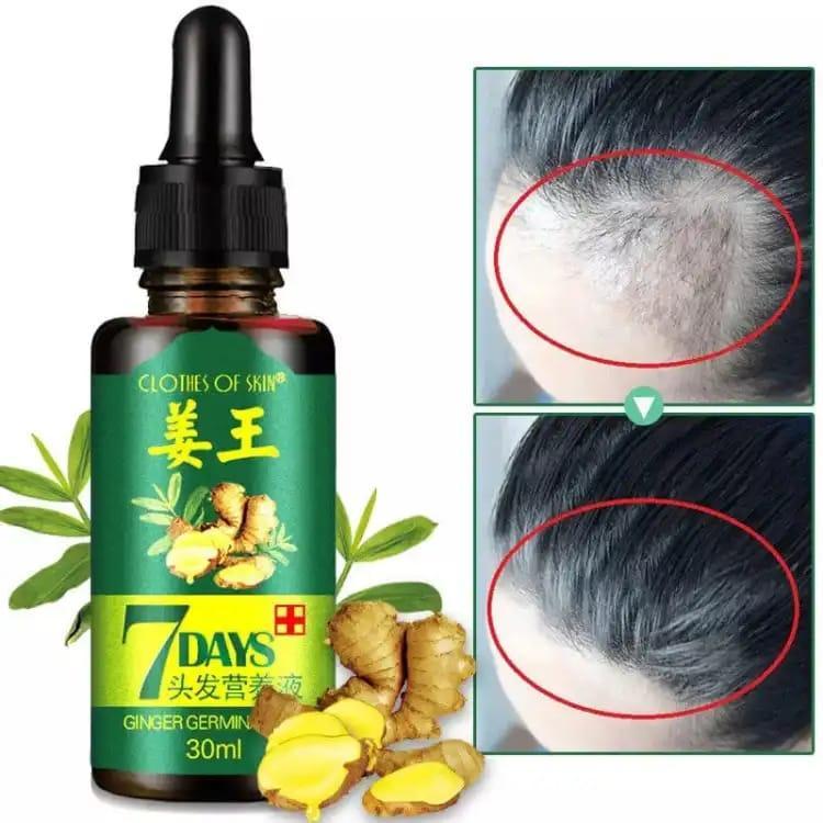 Nourishing Hair Growth Serum - 30ml for All Hair Types, 1 Pcs